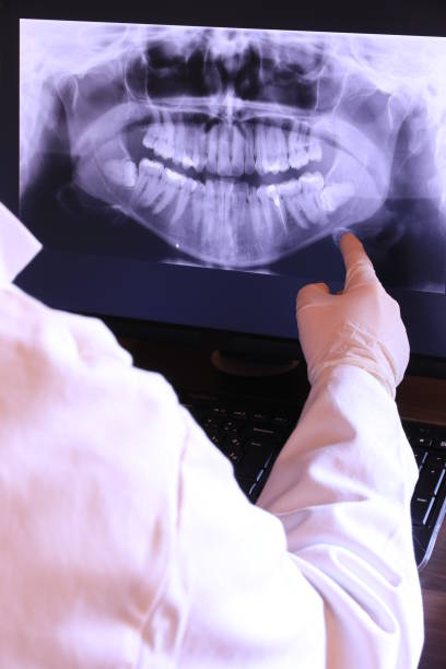 Best Emergency Tooth Extraction in Columbus, NC