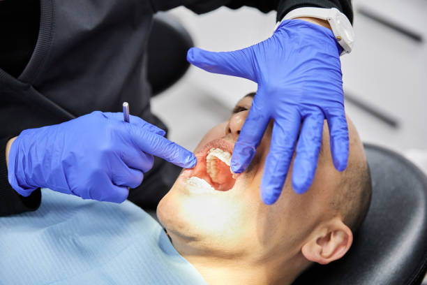 Best Emergency Dental Care for Broken or Chipped Teeth in Columbus, NC