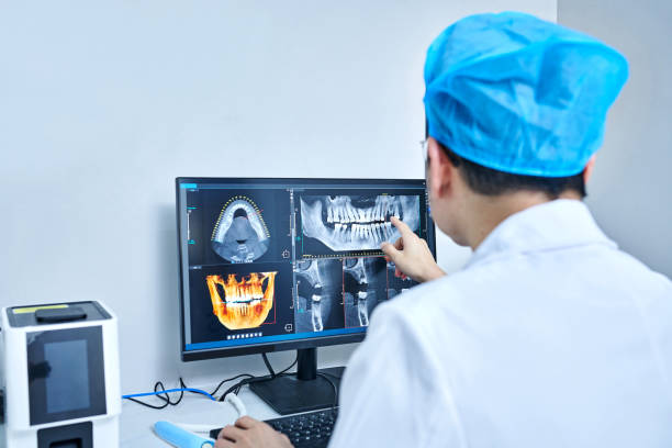 Best Emergency Wisdom Teeth Removal in Columbus, NC