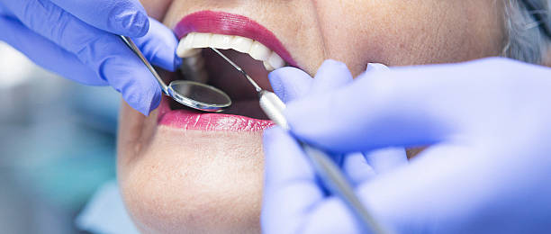 Best Emergency Tooth Extraction in Columbus, NC